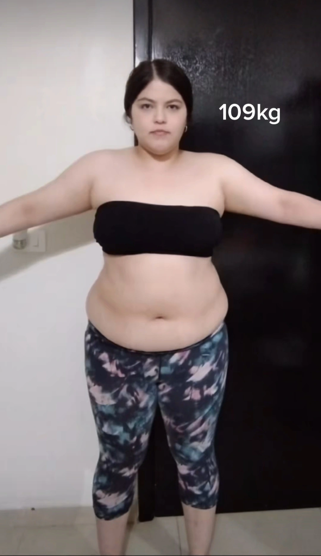 Ana antes del procedimiento