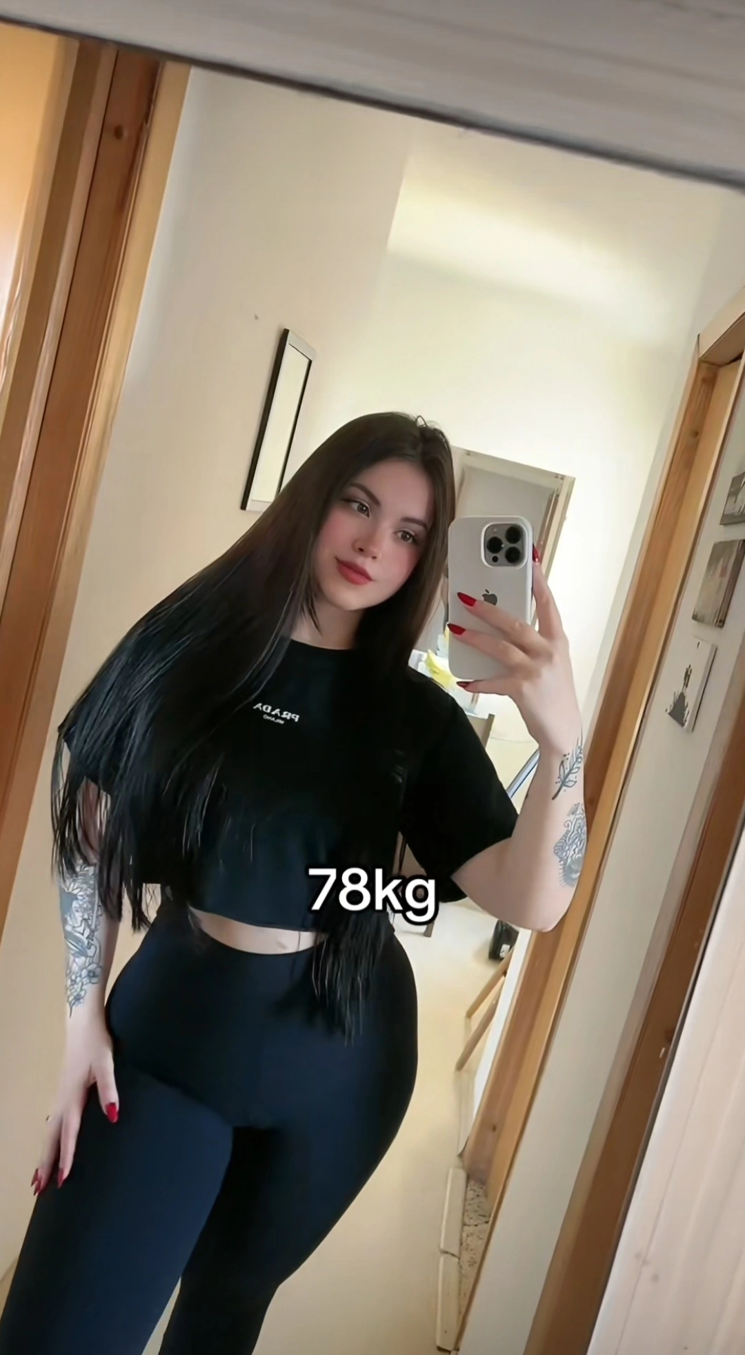 Ana después del procedimiento